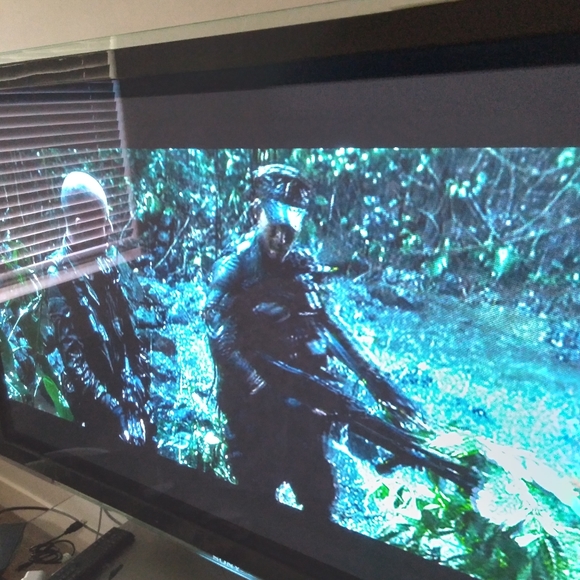 3.1 Phillip Lim Jackets & Blazers - TV's